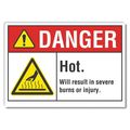 Lyle Hot Surface Danger Label, 5 in H, 7 in W, Polyester, Horizontal Rectangle, English, LCU4-0030-ND_7X5 LCU4-0030-ND_7X5