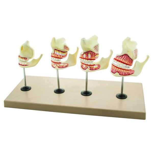 Eisco Scientific Eisco Labs Dentition Model - 4 Stages, 8 Pieces AM0053