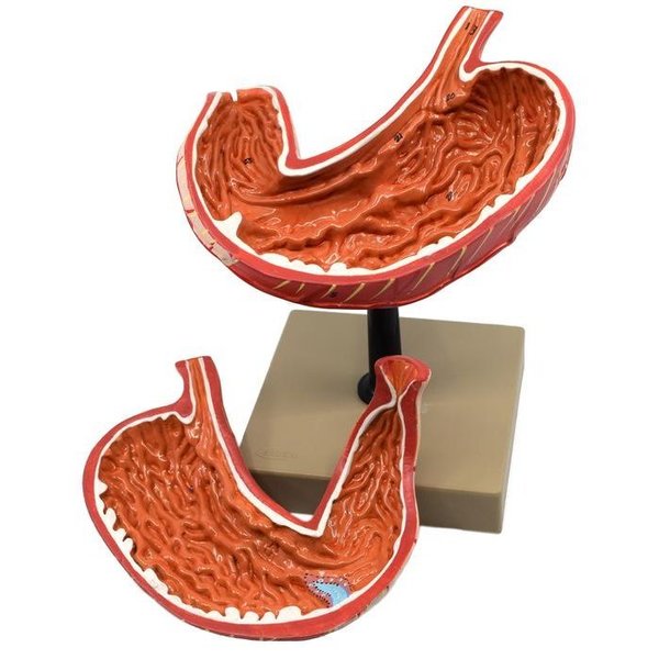 Eisco Scientific Human Stomach Model, 2 Parts, 3-D, Sectional View, Mounted, 5"x5"x7.5" AM0085